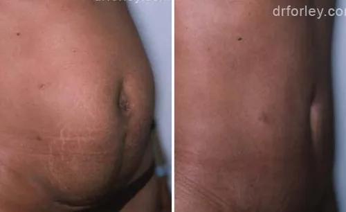 LEARN MORE ABOUT DR. FORLEY'S WORK: BREAST